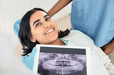 Buy stock photo Shot of a dentist looking over a patients x-rays before a procedure